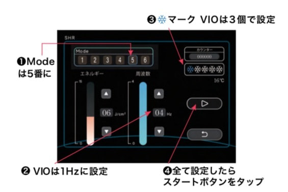 セッティング