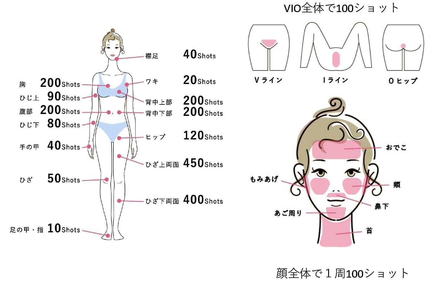 セルフ脱毛ができる箇所